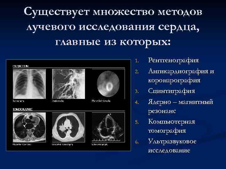 Существует множество методов лучевого исследования сердца, главные из которых: 1. 2. 3. 4. 5.