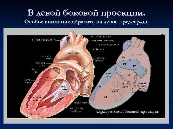 В левой боковой проекции. Особое внимание обратите на левое предсердие Сердце в левой боковой