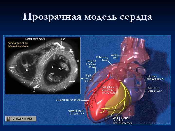 Прозрачная модель сердца 