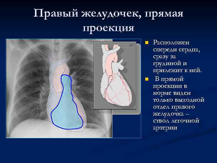 Правый желудочек, прямая проекция n n Расположен спереди сердца, сразу за грудиной и прилежит