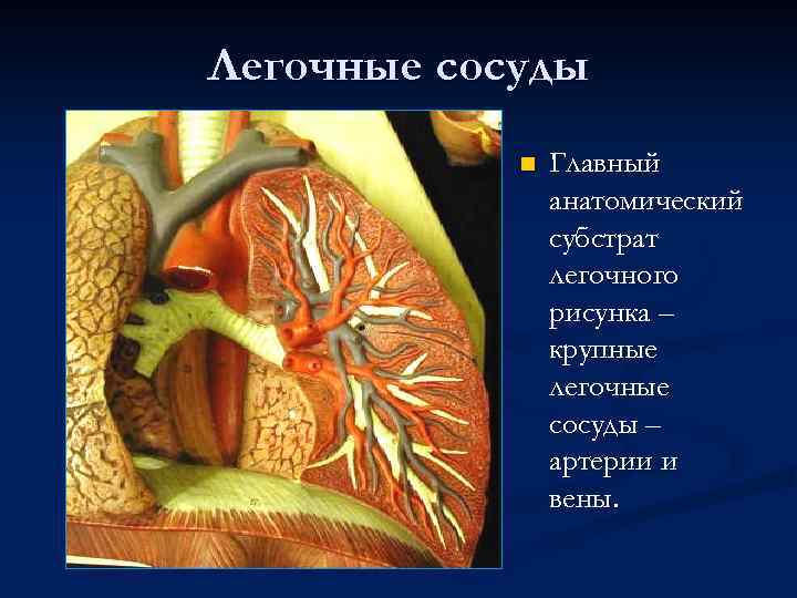 Легочные сосуды n Главный анатомический субстрат легочного рисунка – крупные легочные сосуды – артерии