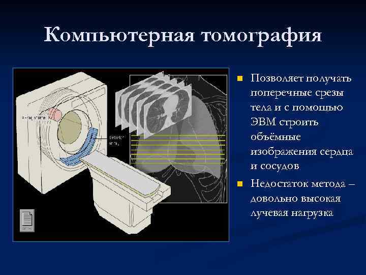 Компьютерная томография n n Позволяет получать поперечные срезы тела и с помощью ЭВМ строить