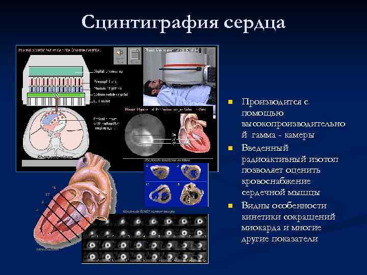 Сцинтиграфия сердца n n n Производится с помощью высокопроизводительно й гамма - камеры Введенный