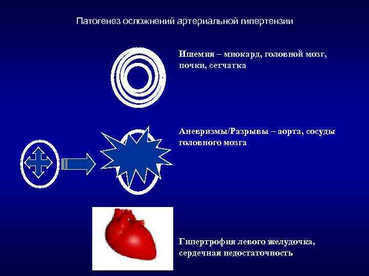 Патогенез осложнений артериальной гипертензии Ишемия – миокард, головной мозг, почки, сетчатка Аневризмы/Разрывы – аорта,