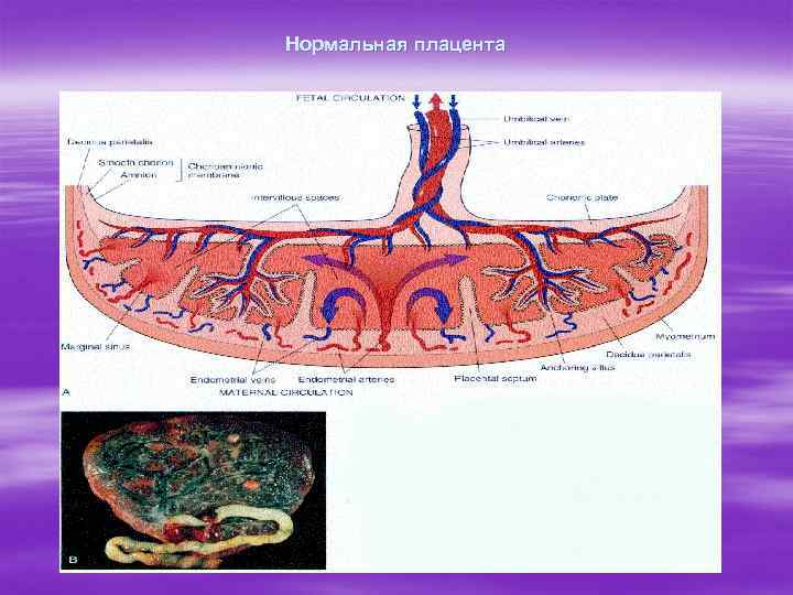 Нормальная плацента 