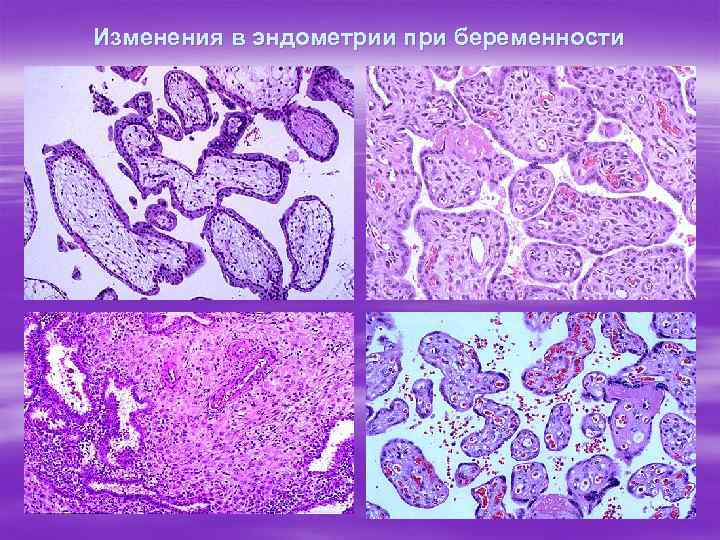 Изменения в эндометрии при беременности 