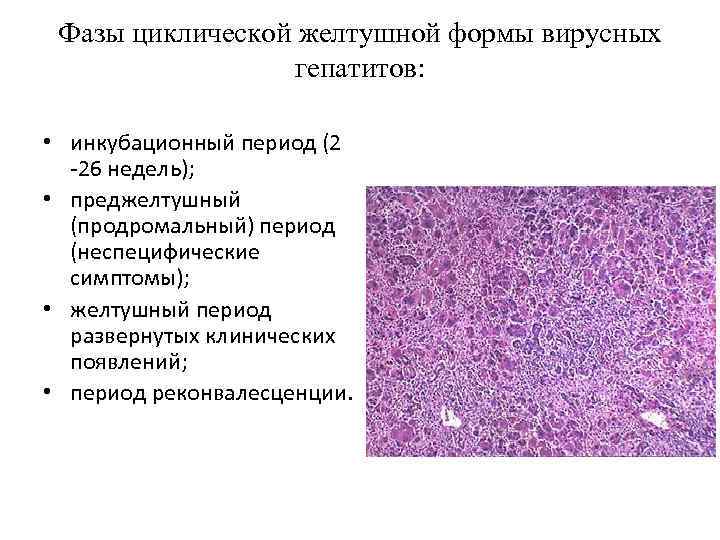 Фазы циклической желтушной формы вирусных гепатитов: • инкубационный период (2 -26 недель); • преджелтушный