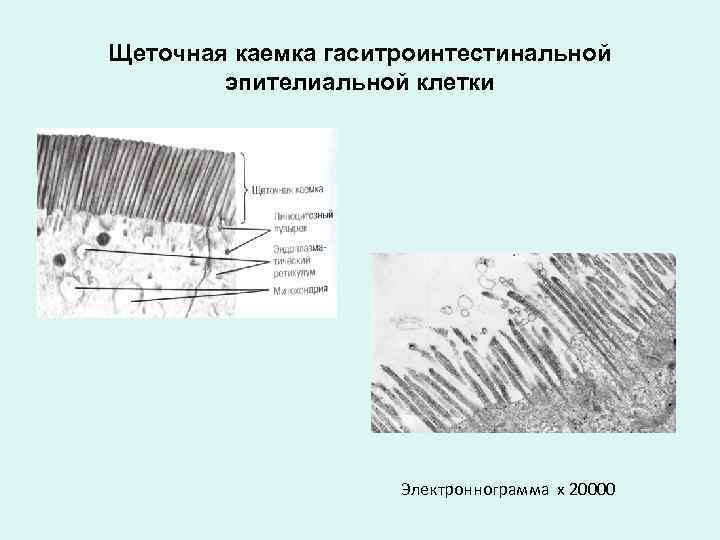 Щеточная каемка гаситроинтестинальной эпителиальной клетки Электроннограмма х 20000 