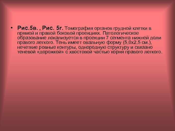  • Рис. 5 в. , Рис. 5 г. Томография органов грудной клетки в