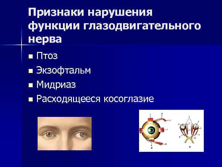 Признаки нарушения функции глазодвигательного нерва Птоз n Экзофтальм n Мидриаз n Расходящееся косоглазие n