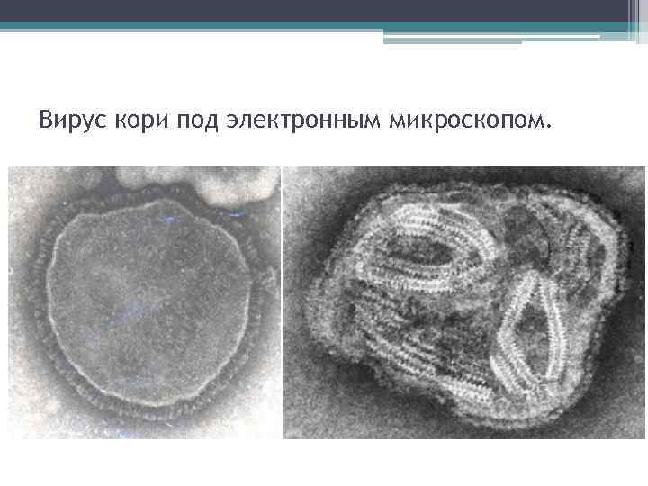 Вирус кори под электронным микроскопом. 