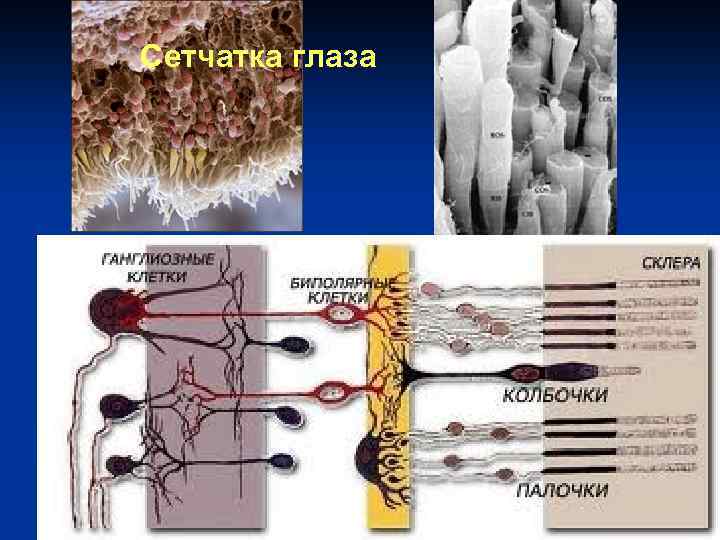 Сетчатка глаза 