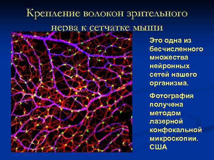 Крепление волокон зрительного нерва к сетчатке мыши Это одна из бесчисленного множества нейронных сетей