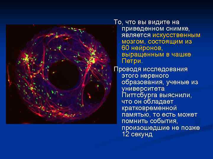 То, что вы видите на приведенном снимке, является искусственным мозгом, состоящим из 60 нейронов,