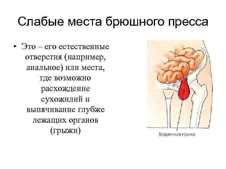 Слабые места брюшного пресса • Это – его естественные отверстия (например, анальное) или места,