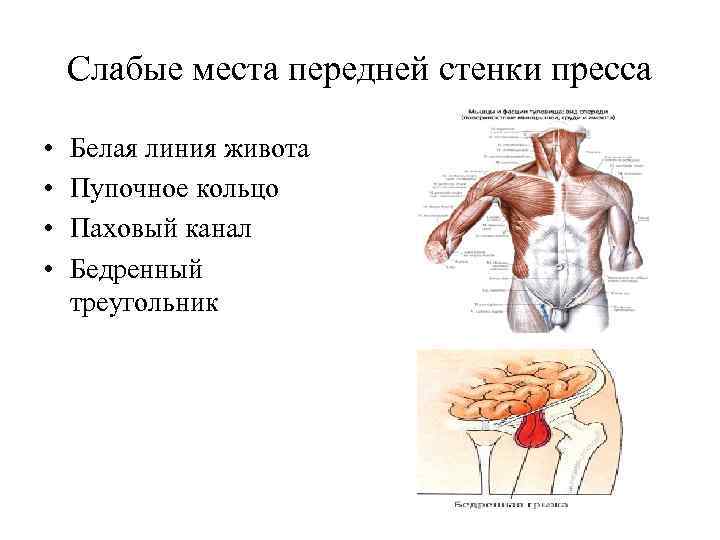 Слабые места передней стенки пресса • • Белая линия живота Пупочное кольцо Паховый канал