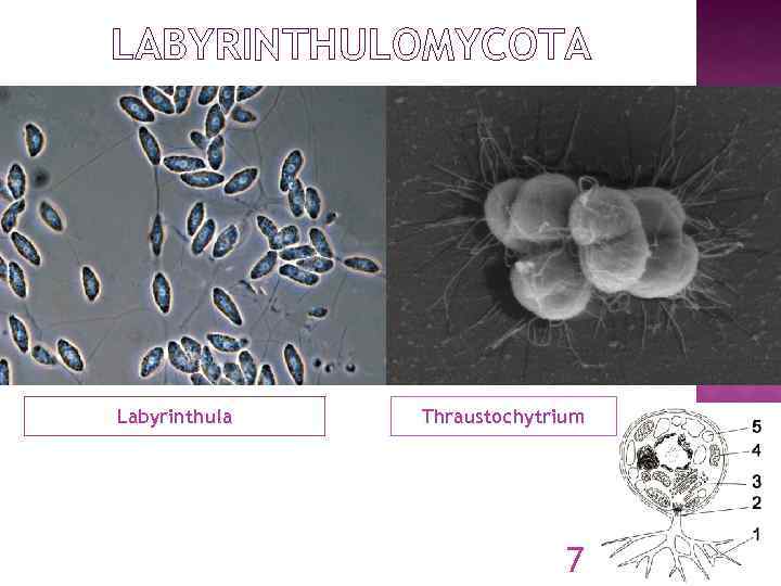 LABYRINTHULOMYCOTA Labyrinthula Thraustochytrium 7 