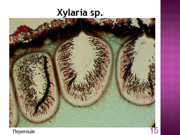 Xylaria sp. Перитецій 15 