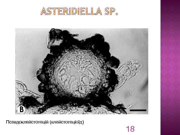 Псевдоклейстотецій (клейстотеціоїд) 18 