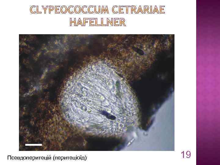 Псевдоперитецій (перитеціоїд) 19 