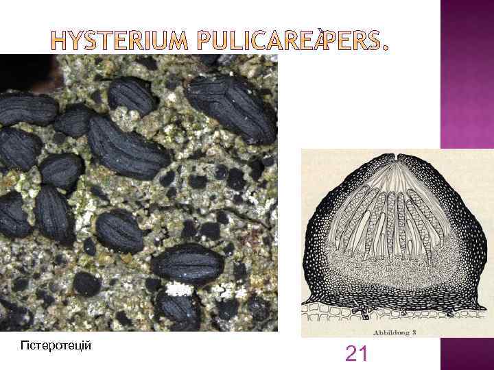 Гістеротецій 21 