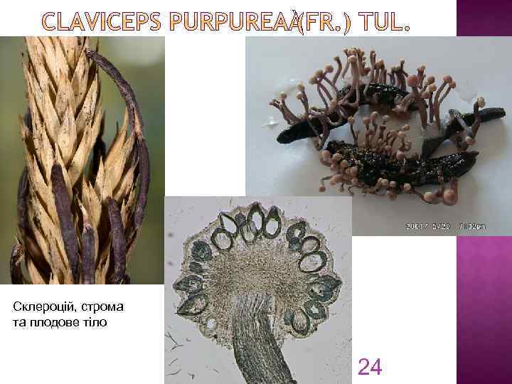 Склероцій, строма та плодове тіло 24 