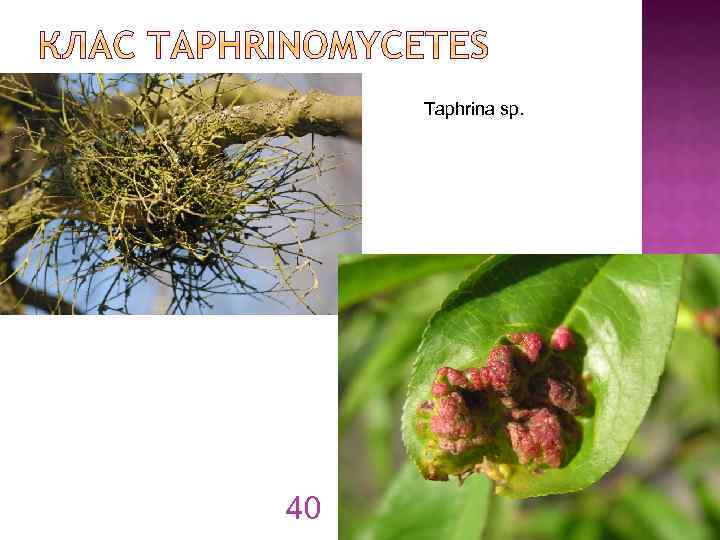 Taphrina sp. 40 