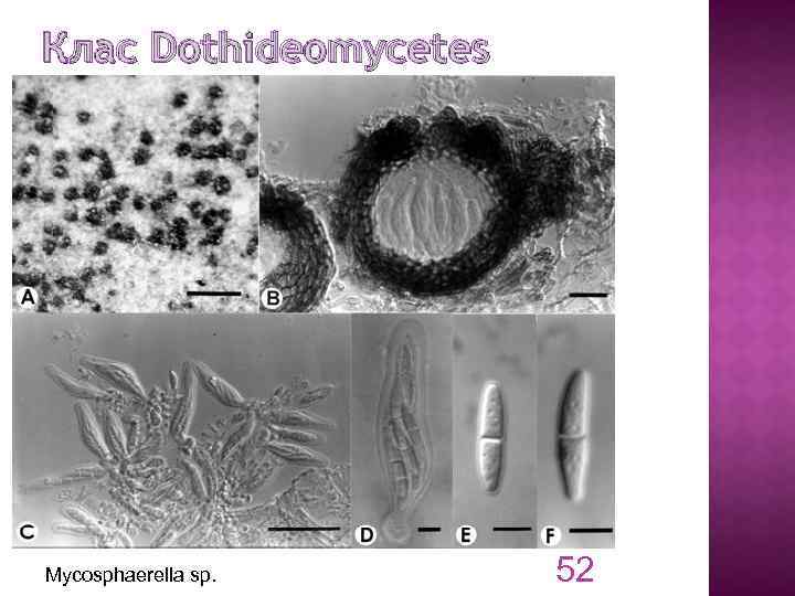 Клас Dothideomycetes Mycosphaerella sp. 52 