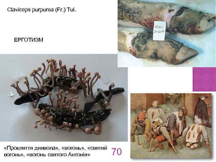 Claviceps purpurea (Fr. ) Tul. ЕРГОТИЗМ «Прокляття диявола» , «вогонь» , «святий вогонь» ,