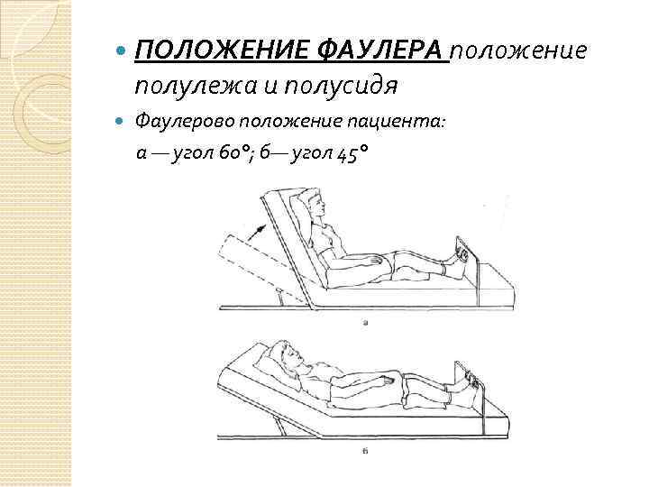 ПОЛОЖЕНИЕ ФАУЛЕРА положение полулежа и полусидя Фаулерово положение пациента: а — угол 60°;