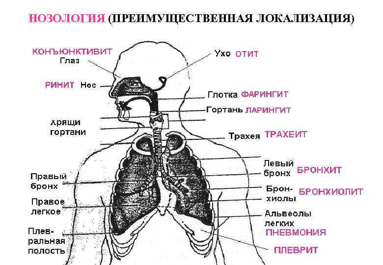 НОЗОЛОГИЯ (ПРЕИМУЩЕСТВЕННАЯ ЛОКАЛИЗАЦИЯ) 
