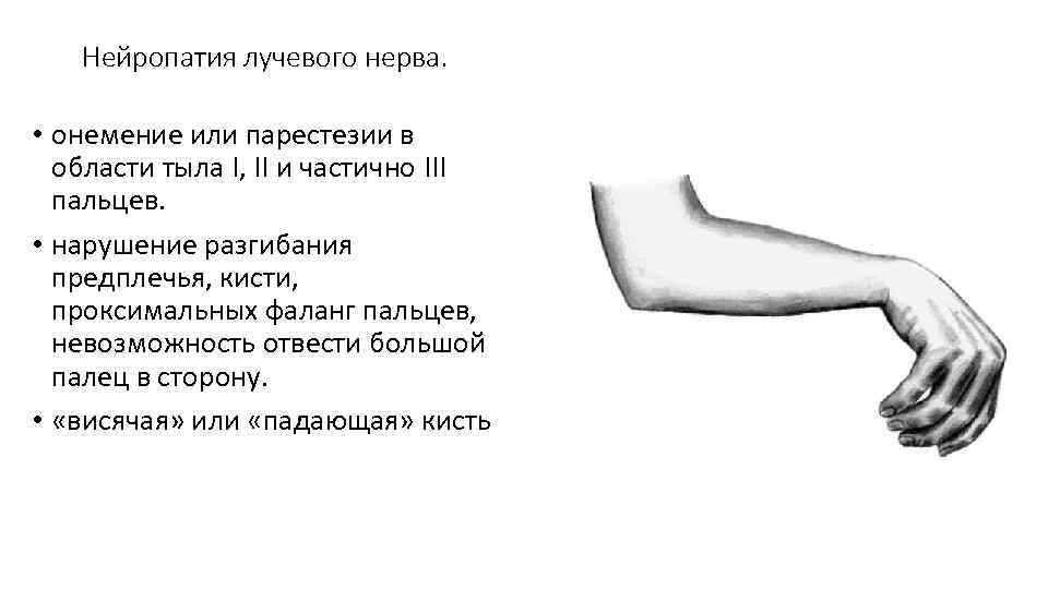 Нейропатия лучевого нерва. • онемение или парестезии в области тыла I, II и частично