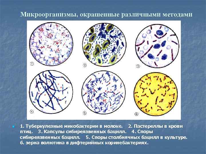 Микроорганизмы, окрашенные различными методами n 1. Туберкулезные микобактерии в молоке. 2. Пастереллы в крови