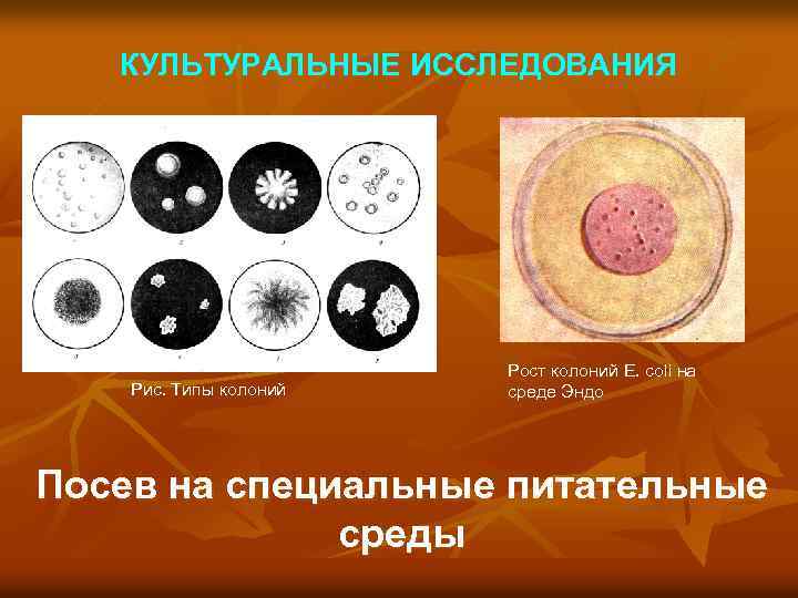 КУЛЬТУРАЛЬНЫЕ ИССЛЕДОВАНИЯ Рис. Типы колоний Рост колоний E. coli на среде Эндо Посев на