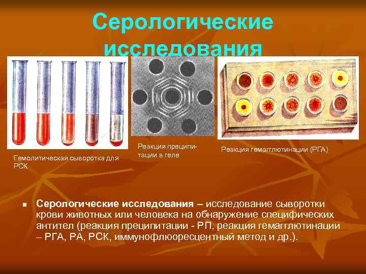 Серологические исследования Гемолитическая сыворотка для РСК n Реакция преципи тации в геле Реакция гемагглютинации