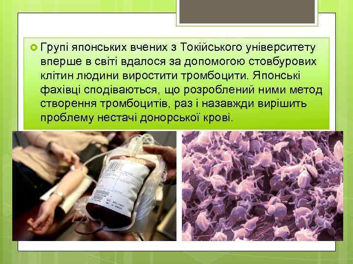  Групі японських вчених з Токійського університету вперше в світі вдалося за допомогою стовбурових