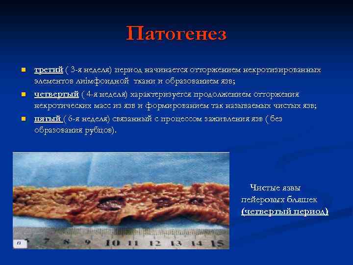 Патогенез n n n третий ( 3 -я неделя) период начинается отторжением некротизированных элементов