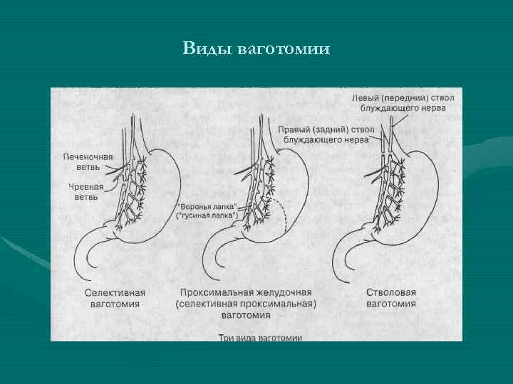 Схема написания истории болезни бгму