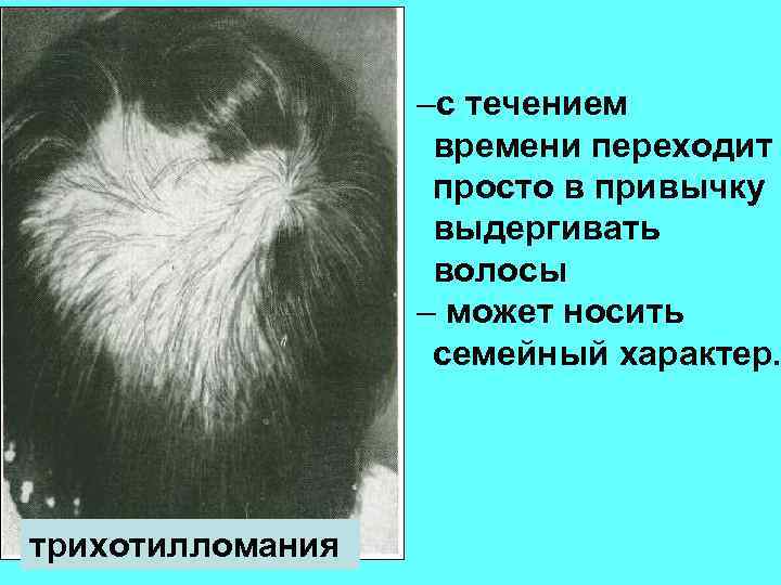 –с течением времени переходит просто в привычку выдергивать волосы – может носить семейный характер.
