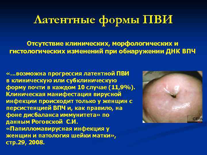 Латентные формы ПВИ Отсутствие клинических, морфологических и гистологических изменений при обнаружении ДНК ВПЧ «…возможна