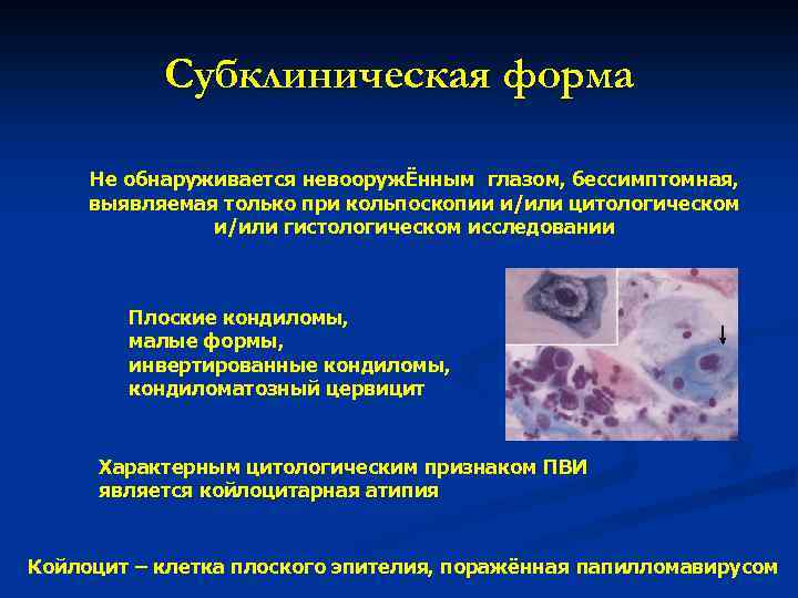 Субклиническая форма Не обнаруживается невооружЁнным глазом, бессимптомная, выявляемая только при кольпоскопии и/или цитологическом и/или