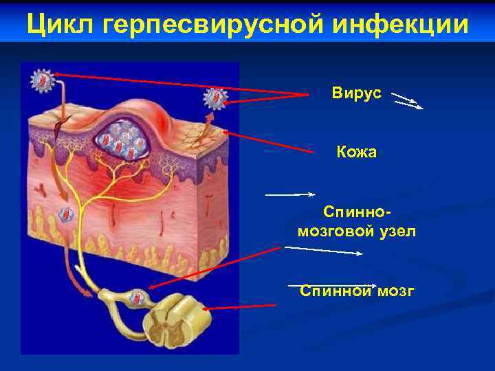 Цикл герпесвирусной инфекции Вирус Кожа Спинномозговой узел Спинной мозг 