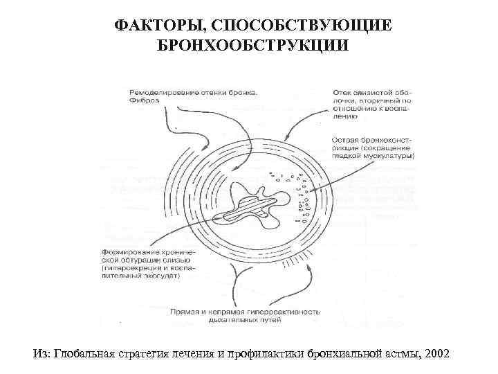 ФАКТОРЫ, СПОСОБСТВУЮЩИЕ БРОНХООБСТРУКЦИИ Из: Глобальная стратегия лечения и профилактики бронхиальной астмы, 2002 