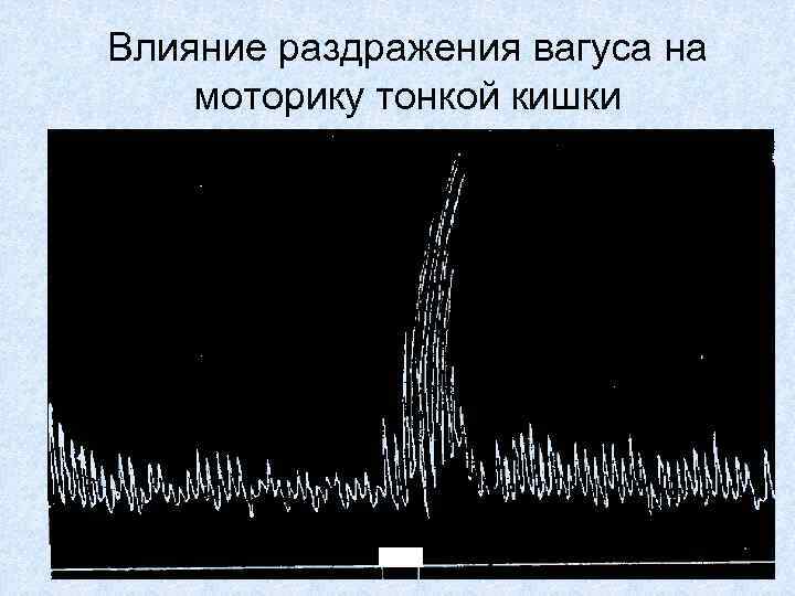 Влияние раздражения вагуса на моторику тонкой кишки 