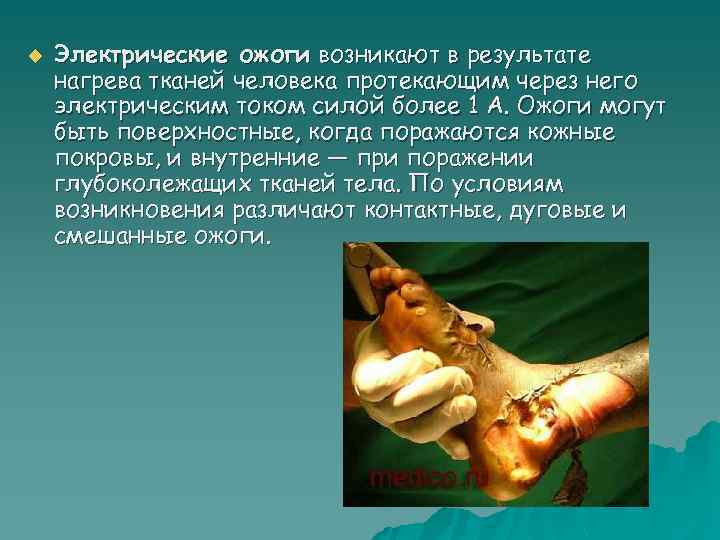 u Электрические ожоги возникают в результате нагрева тканей человека протекающим через него электрическим током