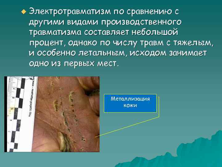 u Электротравматизм по сравнению с другими видами производственного травматизма составляет небольшой процент, однако по