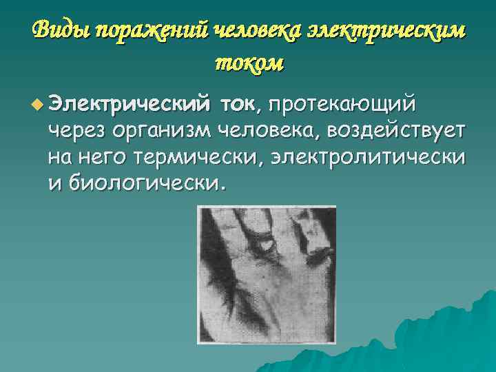 Виды поражений человека электрическим током u Электрический ток, протекающий через организм человека, воздействует на