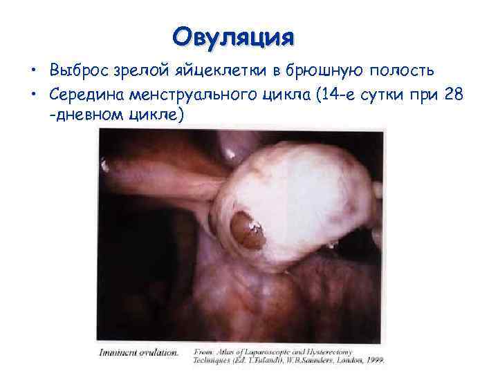Овуляция • Выброс зрелой яйцеклетки в брюшную полость • Середина менструального цикла (14 -е