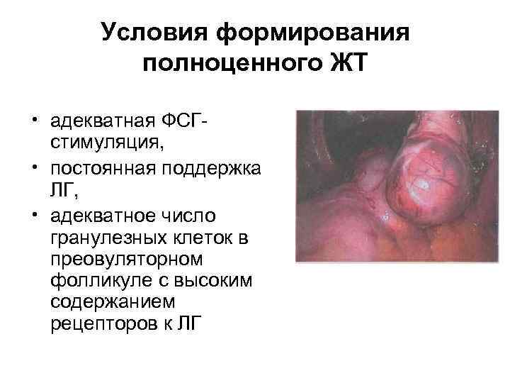 Условия формирования полноценного ЖТ • адекватная ФСГстимуляция, • постоянная поддержка ЛГ, • адекватное число