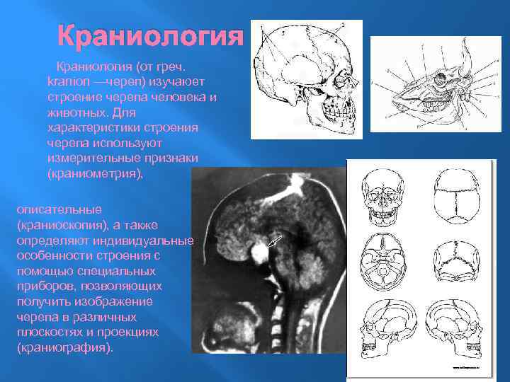 Краниология Краниология (от греч. kraníon —череп) изучаюет строение черепа человека и животных. Для характеристики